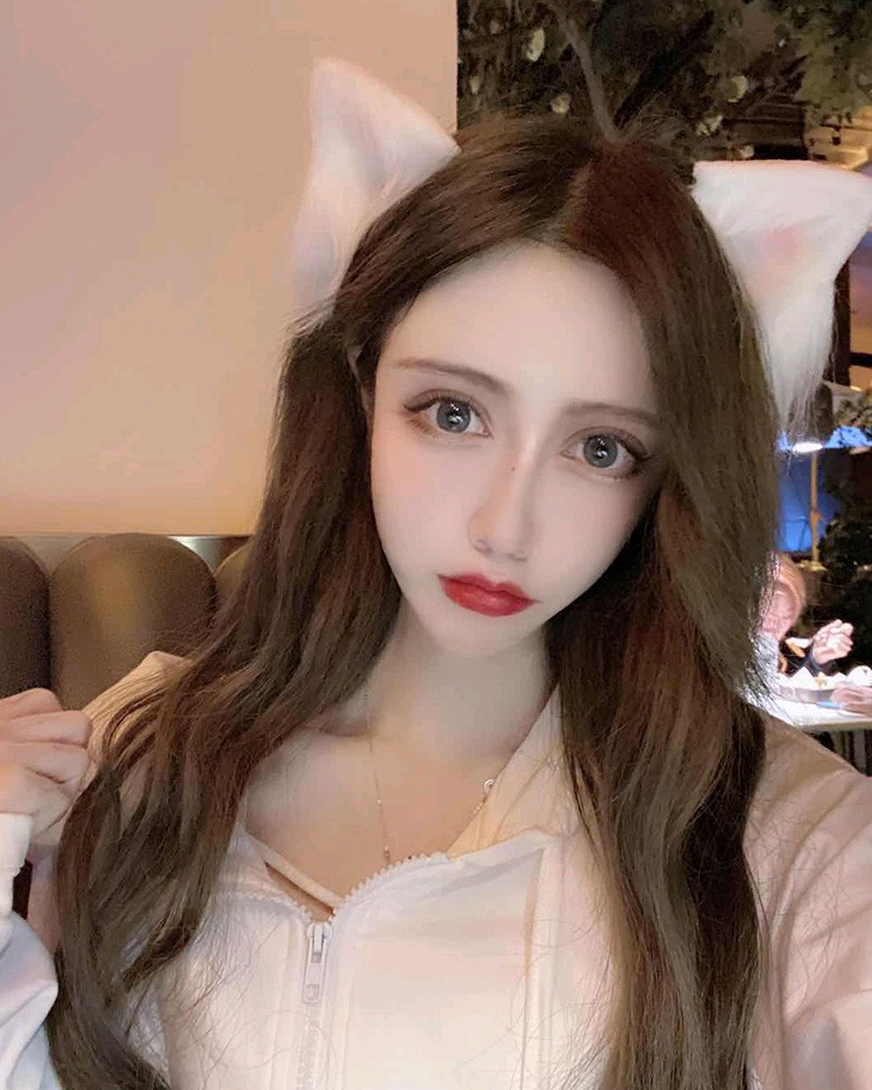 鼻头大,鼻翼宽,鼻子不秀气,鼻梁低平,缺少少女感 定制综合隆鼻改变了我