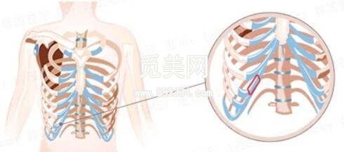 深圳做肋软骨隆鼻价格多少钱？小编了解到了重要信息