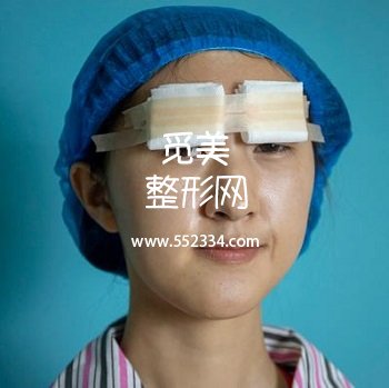 山东省立医院做双眼皮专家介绍【整形价格表一览】