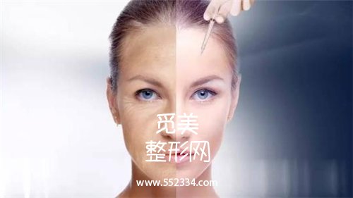 面部大拉皮除皱果怎么样?与哪些因素有关?