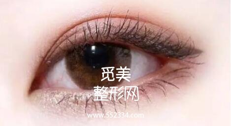 韩式三点式好吗?简单概括一下韩式三点双眼皮的优势!