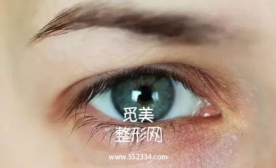 韩式三点式好吗?简单概括一下韩式三点双眼皮的优势!