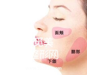 面颊部吸脂手术*吗?容易反弹吗?