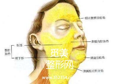 面颊部吸脂手术*吗?容易反弹吗?