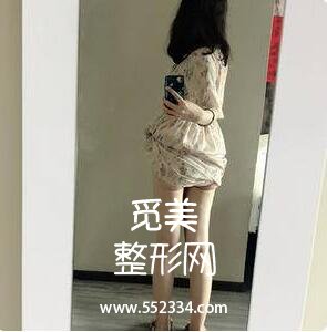 深圳博美王红玮吸脂的技术技术怎么样?案例图分享