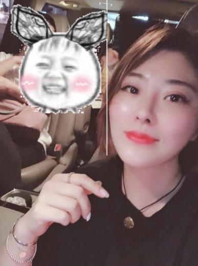 临沂沂水中心医院整形美容科去狐臭怎么样?附价格表及经历分享