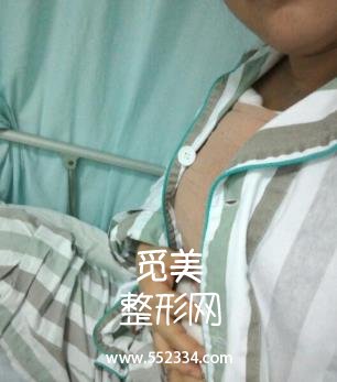 大连新华医院整形科乳房缩小 价格表/巨乳缩小案例图公开分享!