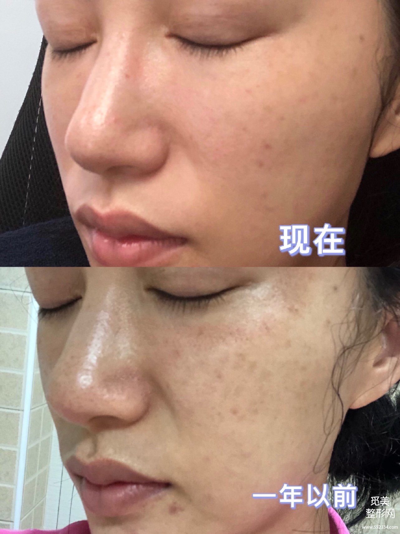 *祛斑价格揭秘:3百块和9千块的超*有区别吗?