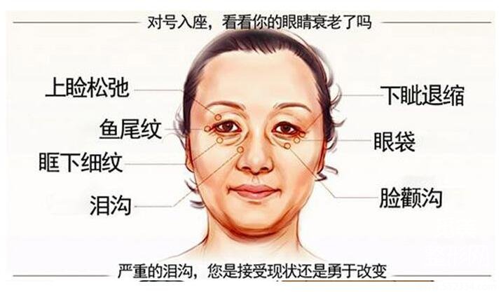 除皱:中下面部皮肤松弛,做PSV面部提升好还是小拉皮提升好?