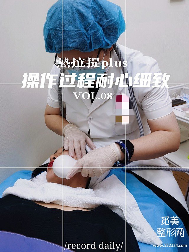 重庆热拉提案例|面部松弛下垂做小热玛吉痛感完全可以忍受!