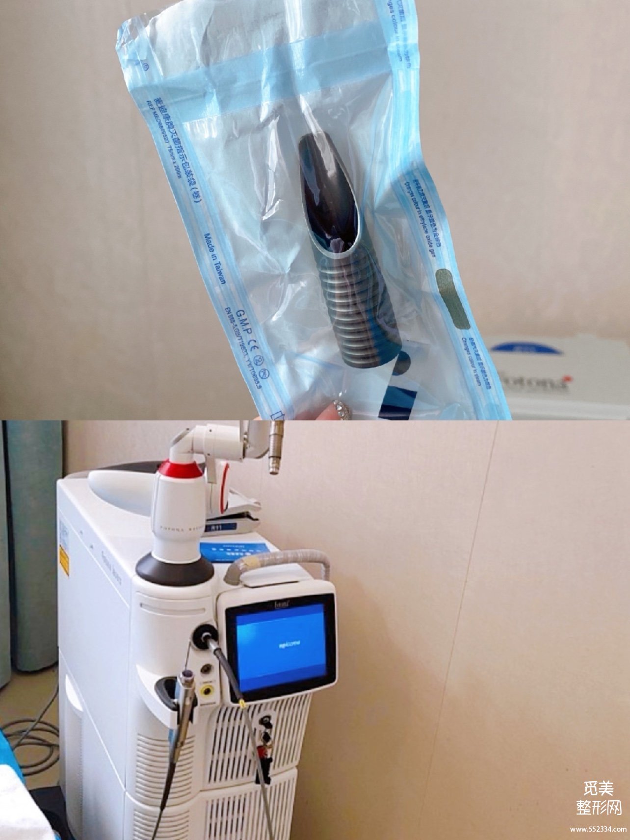 fotona 4d和热玛吉有区别吗?Fotona 4D Pro有没有副作用?案例解析