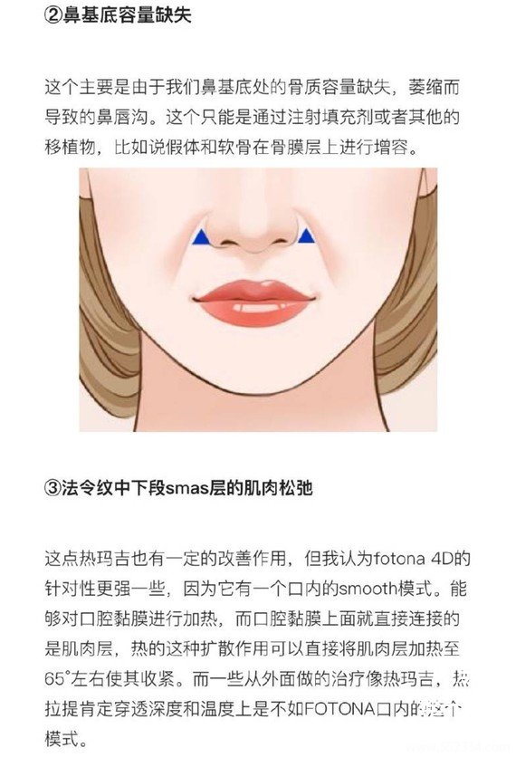 什么年龄适合做热玛吉?热玛吉去法令纹*果好吗?