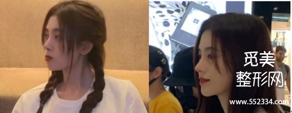 【觅美网】鞠婧祎是怎么变美的?干货分析普通人变美思路