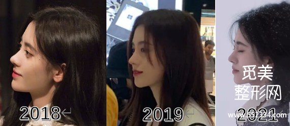 【觅美网】鞠婧祎是怎么变美的?干货分析普通人变美思路
