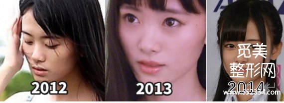 【觅美网】鞠婧祎是怎么变美的?干货分析普通人变美思路