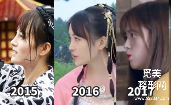 【觅美网】鞠婧祎是怎么变美的?干货分析普通人变美思路