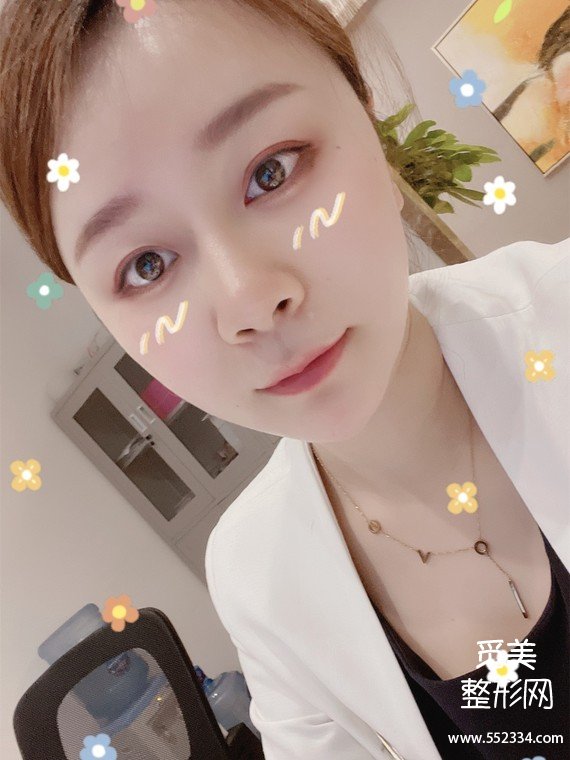 昆明泪沟填充|双美胶原蛋白祛泪沟黑眼圈,我的泪沟终于有救了!!!