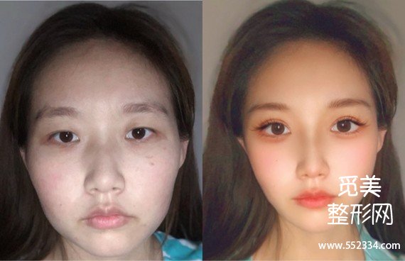 觅美网看脸|素人面部分析,教你怎么逆袭韩式女团脸!
