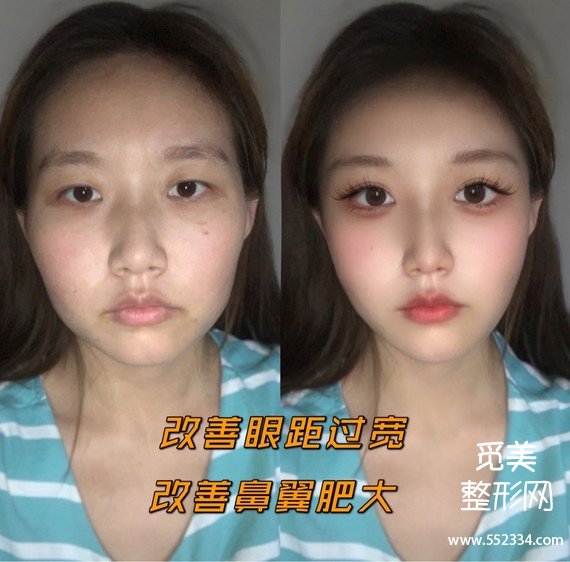 觅美网看脸|素人面部分析,教你怎么逆袭韩式女团脸!