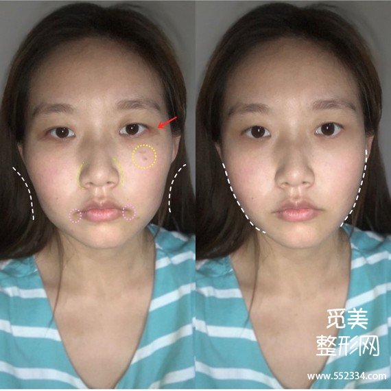 觅美网看脸|素人面部分析,教你怎么逆袭韩式女团脸!