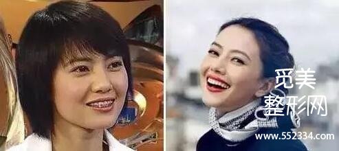 郑州牙齿矫正/种植牙哪里好?河南口腔医院排名前十