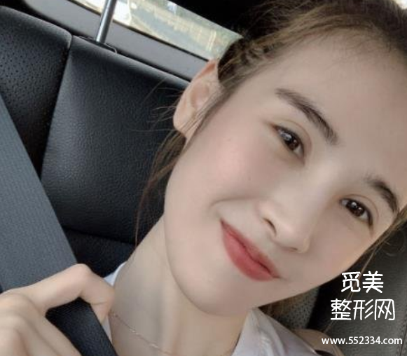 长春面部脂肪填充哪个医院好?案例?长春中妍、吉林铭医、长春西之米