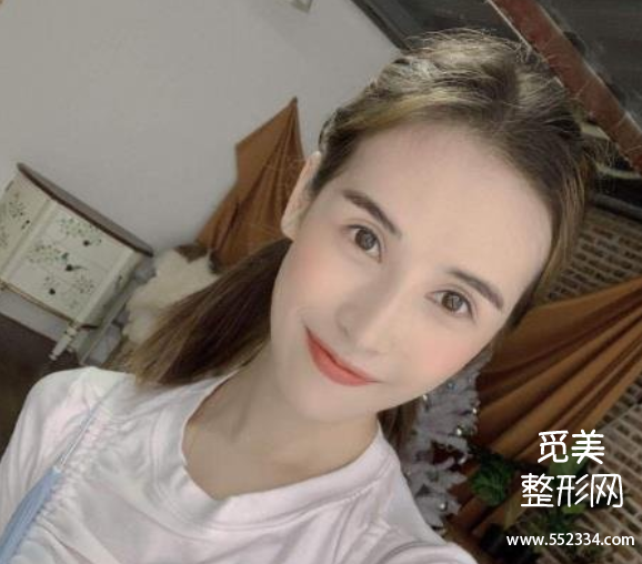 长春面部脂肪填充哪个医院好?案例?长春中妍、吉林铭医、长春西之米