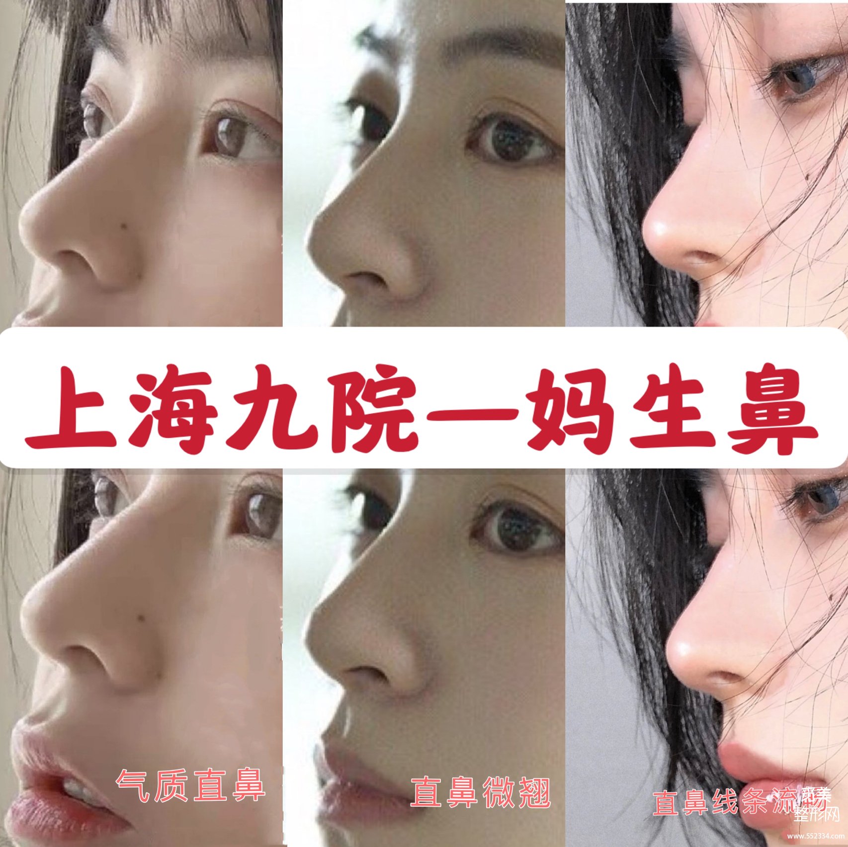 上海九院自然风妈生鼻医生对比：李青峰、李圣利、谢峰
