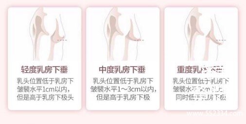 生完孩子感觉胸下垂怎么办?乳房下垂矫正手术怎么做?