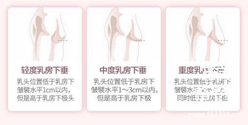 生完孩子感觉胸下垂怎么办？乳房下垂矫正手术怎么做？