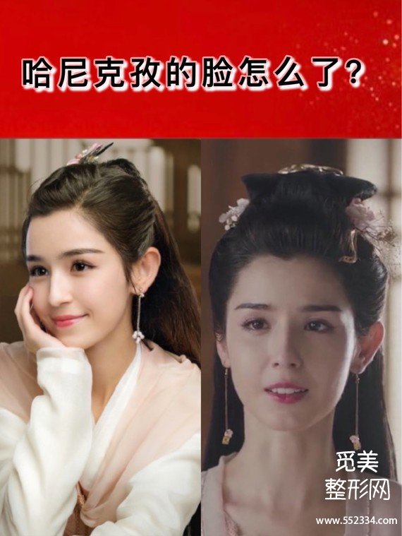 《天舞纪》美到全网夸的哈尼克孜 脸怎么了?