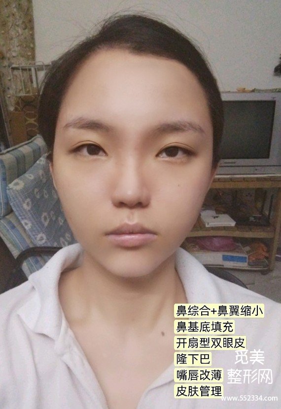 觅美网看脸|扁平脸素人怎么逆袭成猫系长相?