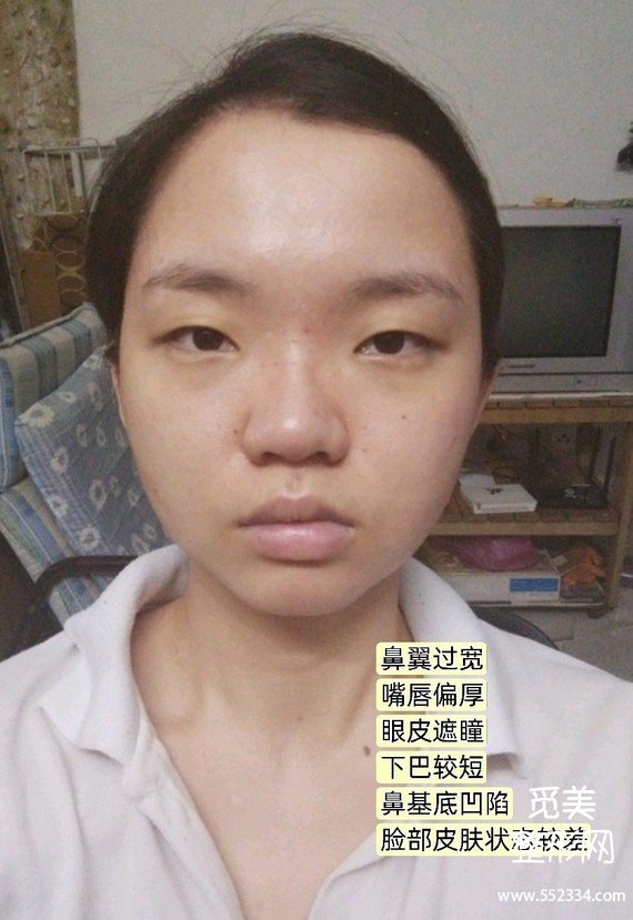 觅美网看脸|扁平脸素人怎么逆袭成猫系长相?
