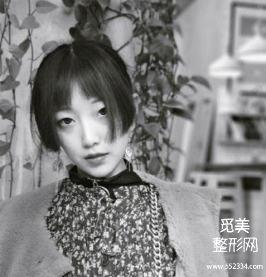 上海隆鼻排行前三的医生!戴传昌、谢卫国、赵延峰附隆鼻案例!