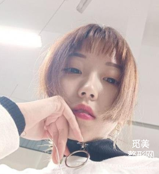 上海隆鼻排行前三的医生!戴传昌、谢卫国、赵延峰附隆鼻案例!