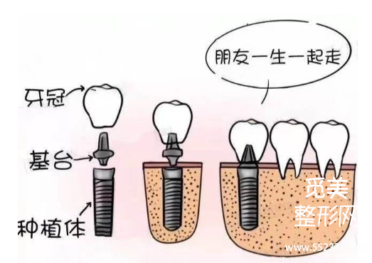 成都种植牙医院口碑测评,排名前三榜单出炉!