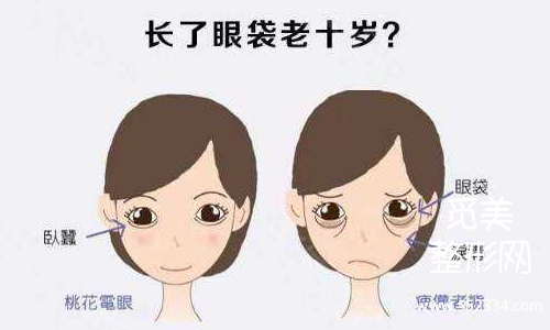 祛眼袋手术费用大概多少钱?割眼袋***有*的方法