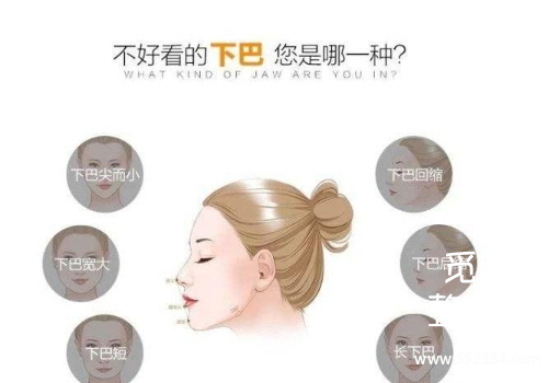 垫下巴什么方式**?下巴整形后遗症有哪些?