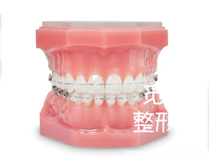 郑州牙齿矫正哪里好?大概需要多少钱?