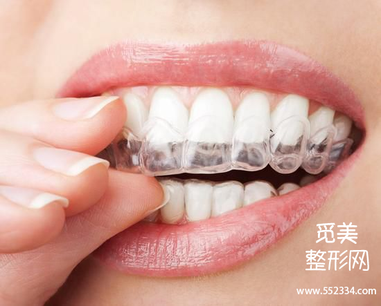 郑州牙齿矫正哪里好?大概需要多少钱?