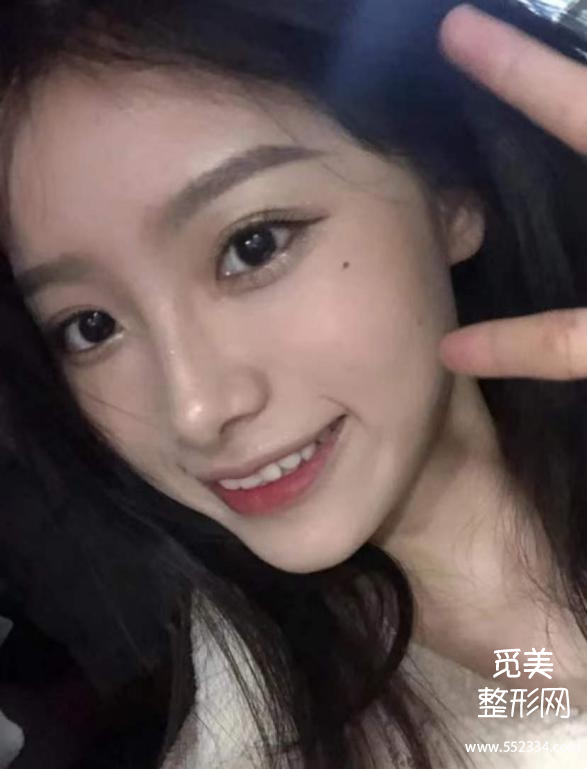 长沙隆鼻医生怎么选择呢?医生审美技术、真实案例*全功课