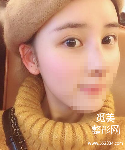 上海谢卫国隆鼻怎么样?大概多少钱?