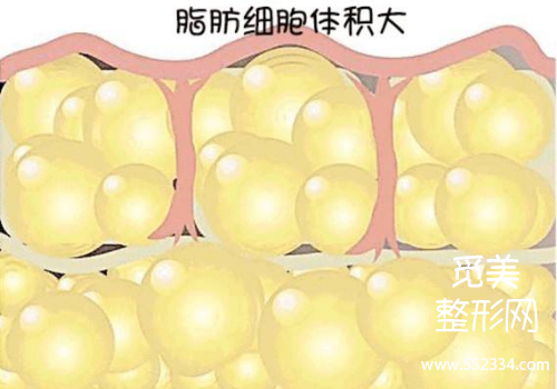 北京东方协和冯斌大腿吸脂怎么样?大概多少钱?