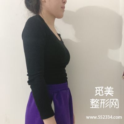 武汉爱思特整形医院怎么样?袁伟医生吸脂大概多少钱?