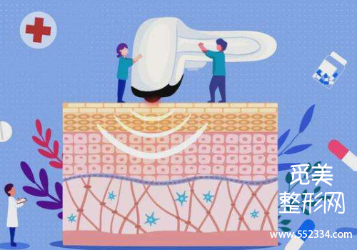 上海九院口碑怎么样?热玛吉哪个医生做得好?