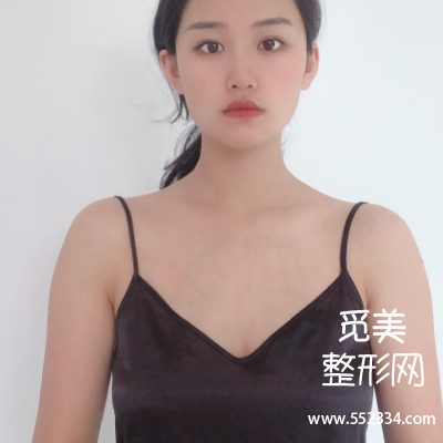 北京八大处医院正规吗?假体隆胸怎么样?价格多少?