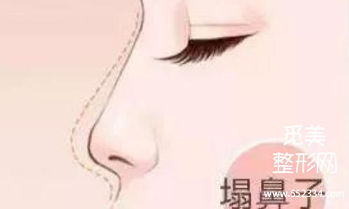重庆*哪个医生做得好?附真实案例+价格