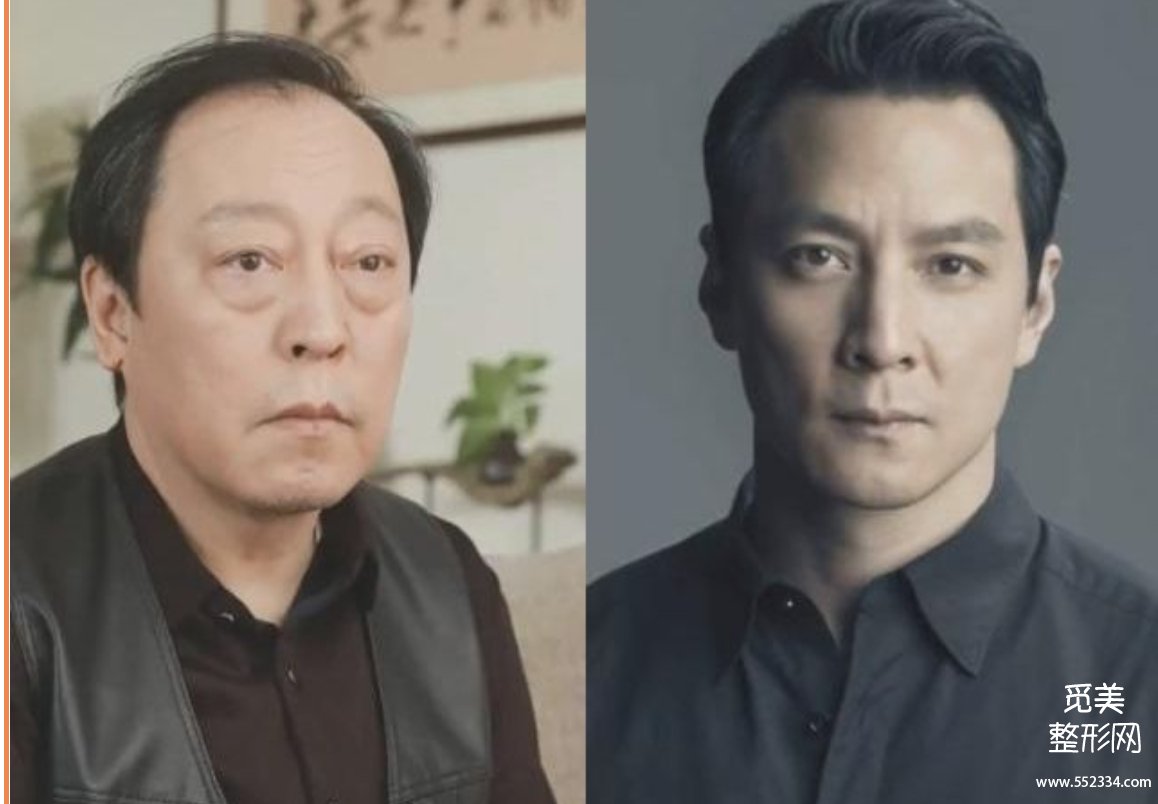 泪沟填充的材料怎么选？如何*大程度避免丁达尔现象？