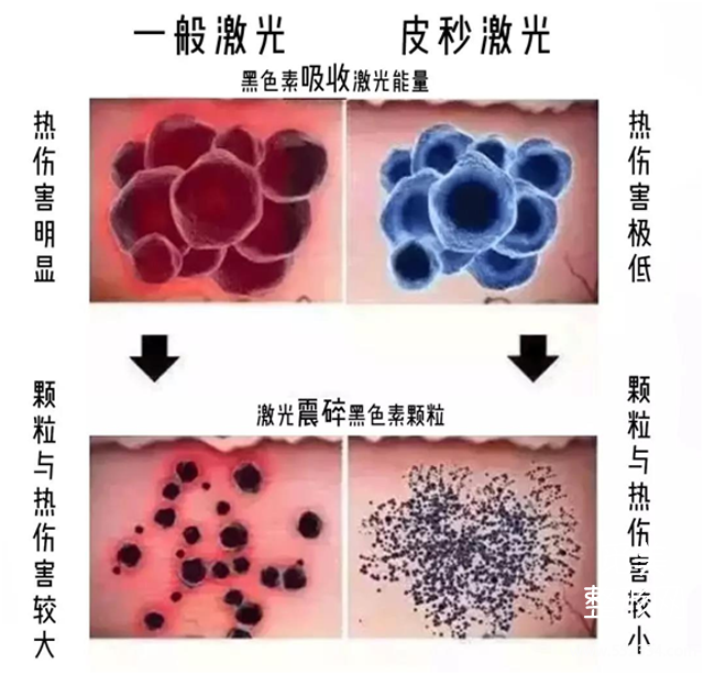 祛黄褐斑的方法*全解答!有黄褐斑困扰的姐妹进来看!