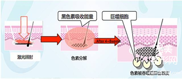 祛黄褐斑的方法*全解答!有黄褐斑困扰的姐妹进来看!